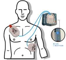 flashing blue button for step by step CPR coaching. Continue to follow 