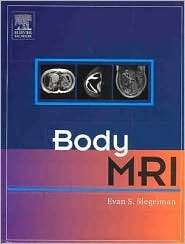 Body MRI, (072163740X), Evan S. Siegelman, Textbooks   