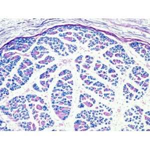  Normal Human Median Nerve Cross Section, Luxol Fast Blue Stain 