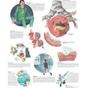  Asthma Chart