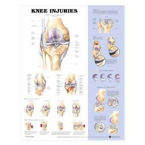 Knee Injuries Chart  Industrial & Scientific